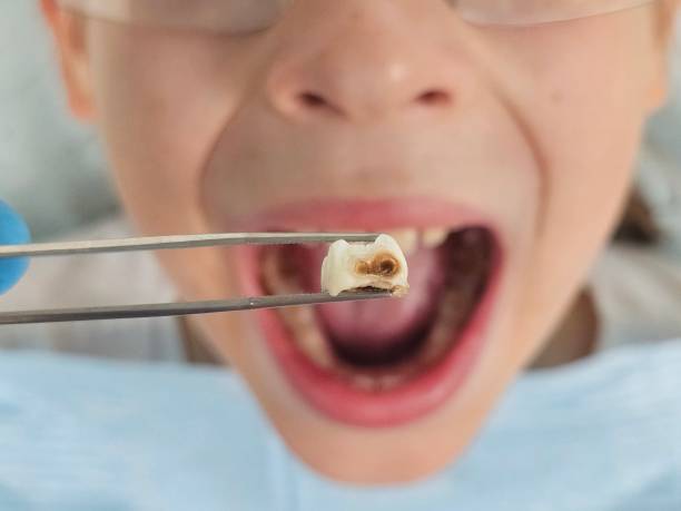 Best Pediatric Emergency Dentist in Knoxville, IA